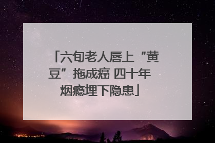 六旬老人唇上“黄豆”拖成癌 四十年烟瘾埋下隐患